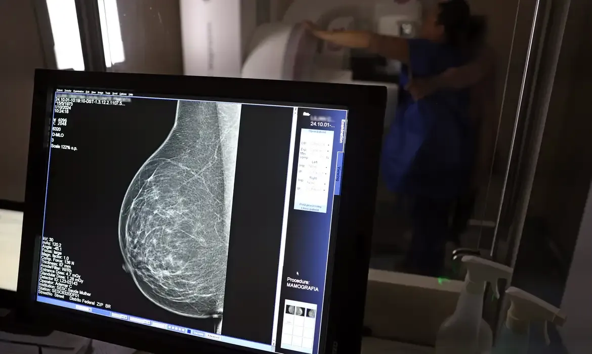 Quase 2 mil mulheres morreram na última década no Amazonas vítimas de câncer de mama - Deixa eu te falar